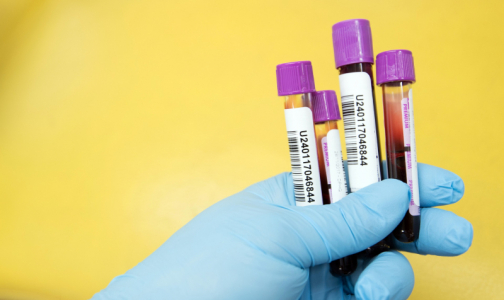 Частные лаборатории начинают тестирование на «ранние» антитела к коронавирусу в Петербурге