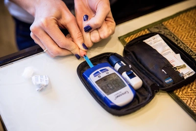 ФАС обнаружила картельный сговор в закупках медоборудования