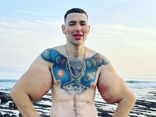 «Руки-базуки» Кирилл Терешин может остаться без конечностей: блогеру с огромными бицепсами грозит ампутация