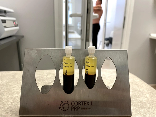 Cortexil/PRP-терапия | Источник: «Медицина Сибири»