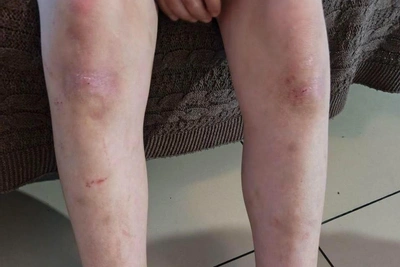 Tyumen Foster Mother Denies Child Abuse Claims