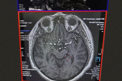 Doctors save 80-year-old Ryazan woman from stroke on Christmas