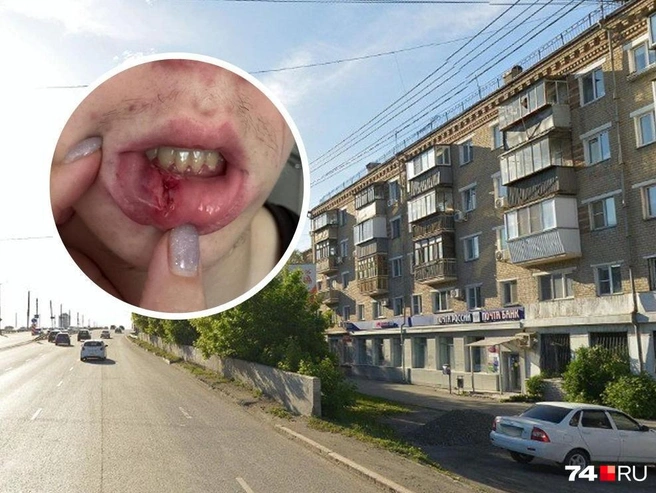 Парня сильно избили среди бела дня в Ленинском районе | Источник: Яндекс.Карты, читатель 74.RU, Семен Казьмин