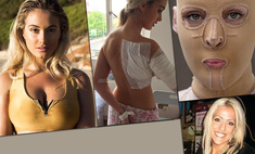 Модели и обычные девушки, которых облили кислотой: фото до и после