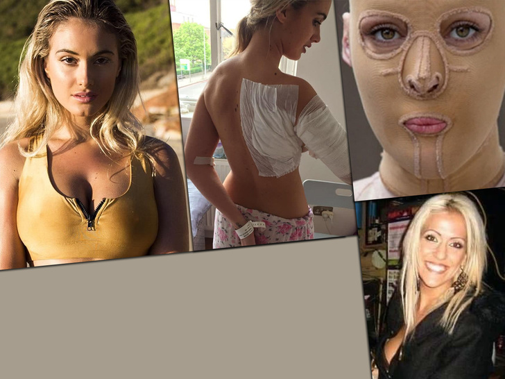 Модели и обычные девушки, которых облили кислотой: фото до и после