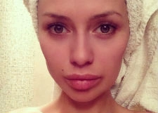 Виктория Боня расстроила поклонников пухлыми губами
