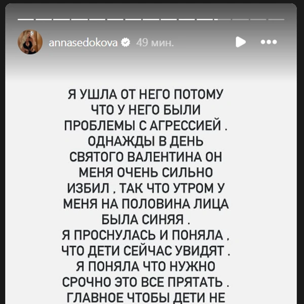 Анна Седокова рассказала об отношениях  | Источник: annasedokova / Instagram.com (экстремистская организация, деятельность запрещена на территории РФ)
