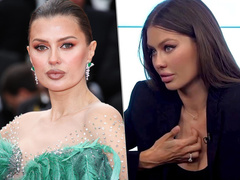 Виктория Боня до и после пластики: сраниваем «старое» и «новое» лицо 44-летней знаменитости