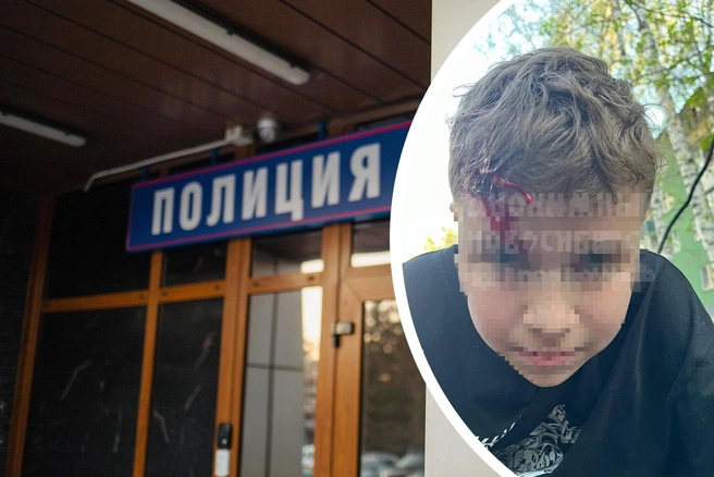 Малька отправили на снятие побоев | Источник: «Анонимный Новосибирск» / Telegram, Алина Скитович / NGS.RU