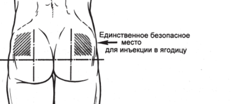 Шок! Оказывается, ты всю жизнь пользовался попой неправильно