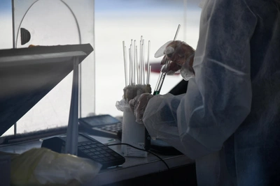 36 детей заболели сальмонеллезом в Тюменской области