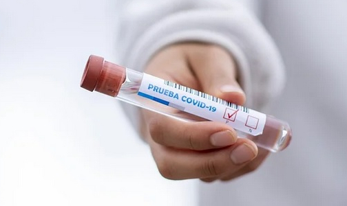 Тесты на коронавирус в поликлиниках обещают сделать доступнее. С 2021 года их включат в программу ОМС