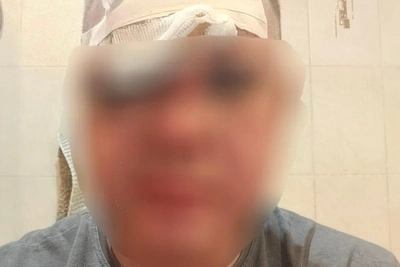 В Волгограде мужчину жестоко избили в новогоднюю ночь