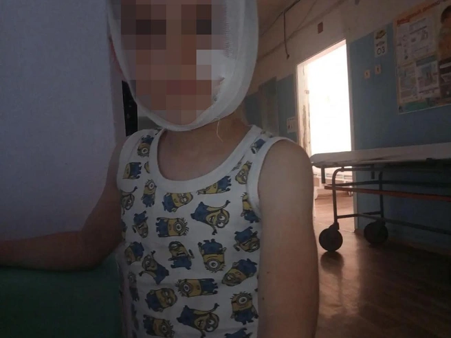 Пострадавший ребенок продолжает стационарное лечение | Источник: читатель V1.RU