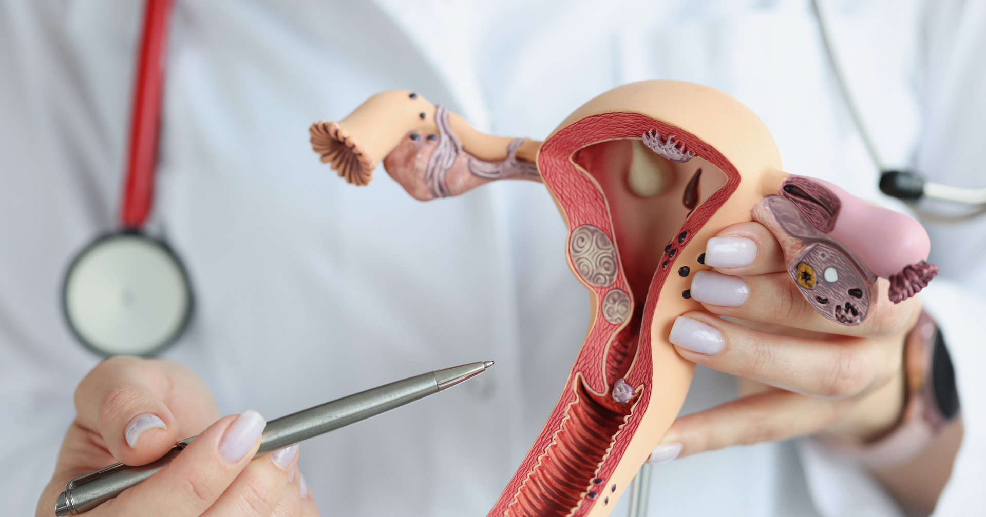 Бактериальный вагиноз - причины появления, симптомы, диагностика и лечение