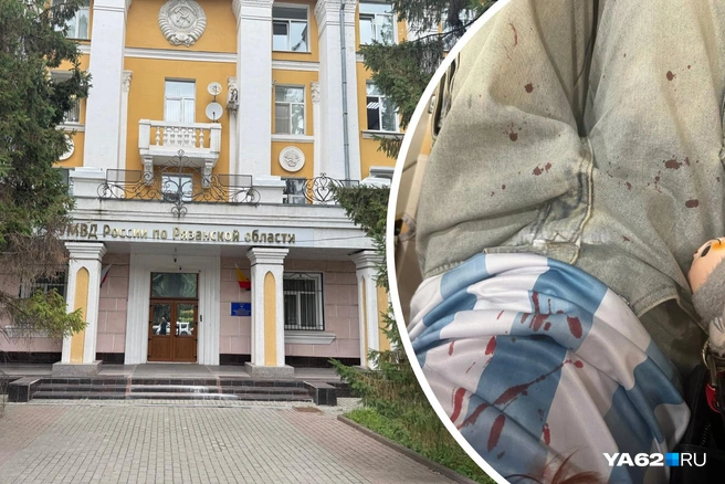 Девушке сломал нос футбольный фанат | Источник: Кристина Мельникова / YA62.RU, telegram-канал «Рязань. Происшествия»