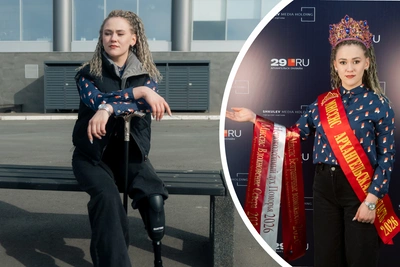 После трех ампутаций мама выиграла конкурс красоты