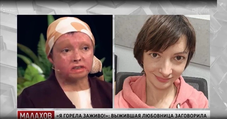 Инна Цыбасова весной впервые за долгое время появилась в студии Андрея Малахова | www.starhit.ru