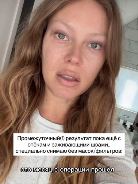 Дакота по сей день восстанавливается