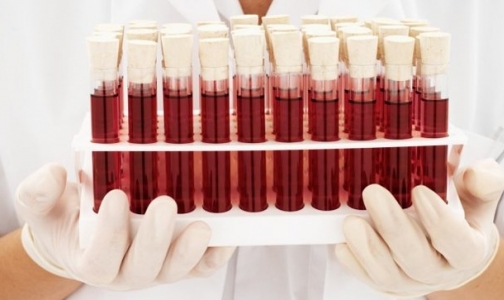 ФМБА: регионы экономят на оборудовании для учреждений службы крови