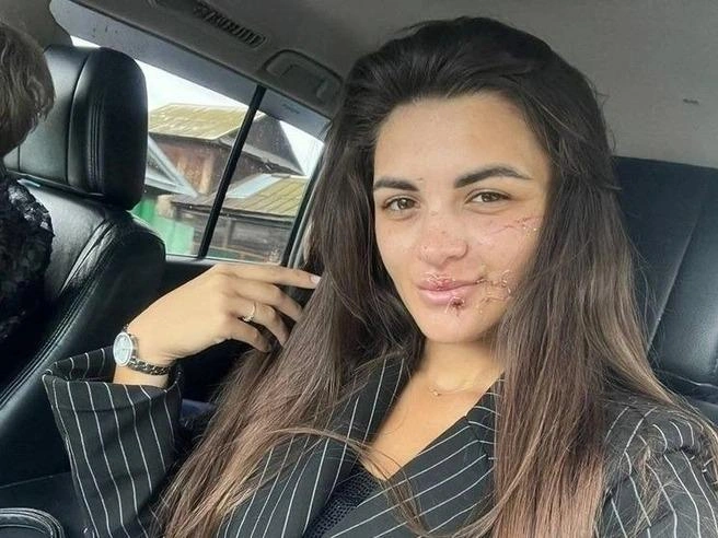 Девушка говорит, что была знакома с нападавшим, но никаких отношений с ним у нее не было | Источник: Из личного архива Ольги Щигоревой