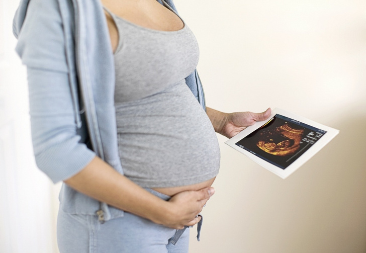 29-летняя девственница забеременела с помощью ЭКО и намерена после родов не подпускать к себе мужчин