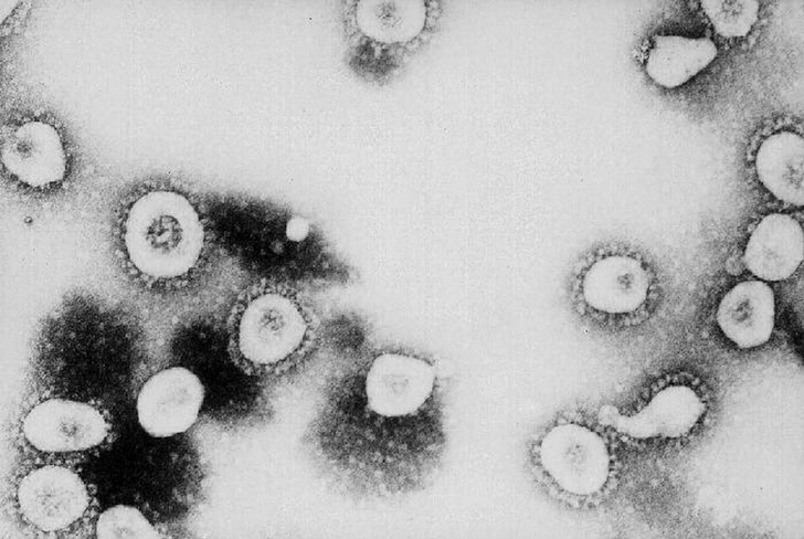 Всего 4 731: в России зафиксировано еще 582 случая заражения коронавирусом
