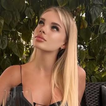 «Преступник не помогает материально»: модель Анжелику Тартанову, оставшуюся без половины черепа, ждет сложная операция