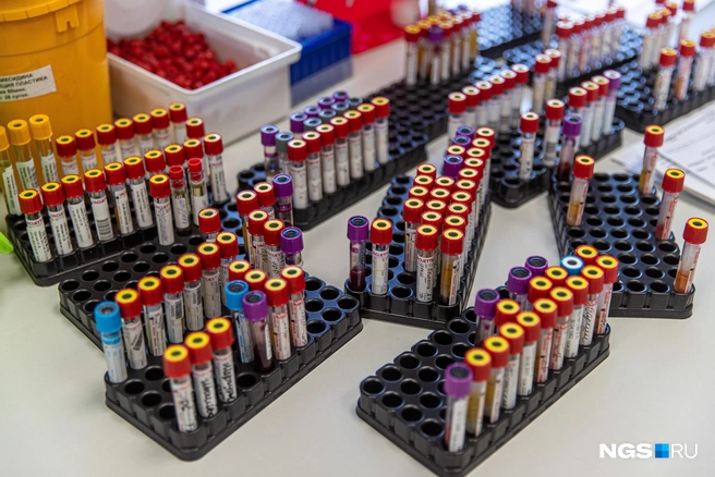 Уровень кортизола можно оценить не только по анализу крови, но и по слюне | Источник: Александр Ощепков / NGS.RU