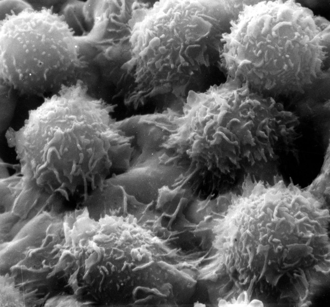 Раз клетка, два клетка: как рак стал двигателем эволюции, а эволюция привела к раку