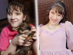 14 лет назад в России разделили сиамских близняшек Элю и Виолу: как они живут сейчас?
