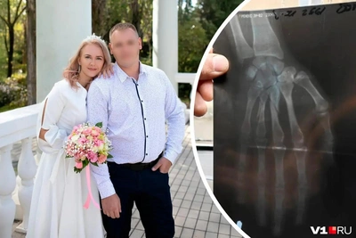 Дело о переломе руки многодетной матери