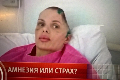 Модель Анжелика Тартанова вышла из комы после травмы