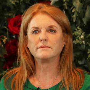 Герцогиня Йоркская рассказала о пластических операциях