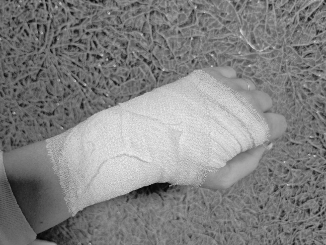 «Последствия после сноуборда. Перелома, к счастью, нет, на выходных опять поеду кататься», — написала Анастасия. | Источник: читательница E1.RU