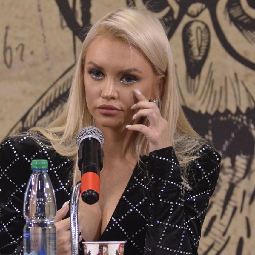 Милана Тюльпанова, перенесшая более 10 пластик: «Анализирую последствия каждой из операций»