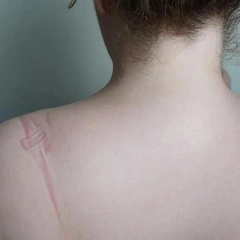 Не говорите «все будет хорошо»: как поддержать себя и других, если у вас рак