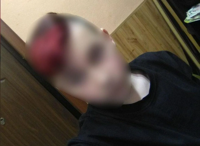 Мурманский подросток, избивший и закопавший 11-летнего мальчика, оказался убийцей | ya62.ru