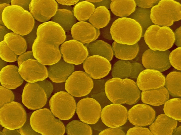 Бактерия Methylococcus capsulatus, используемая для производства белка | Источник: Science Photo Library via Legion Media 