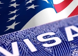 США не будут выдавать визы людям, больным раком, диабетом и ожирением