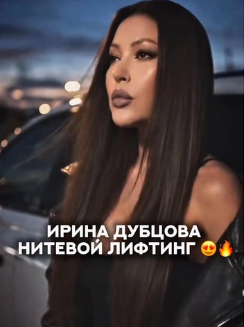 Певица показала результат после нитевого лифтинга | Источник: dr.totikova_ilona2 / Instagram (экстремистская организация, деятельность запрещена на территории РФ)