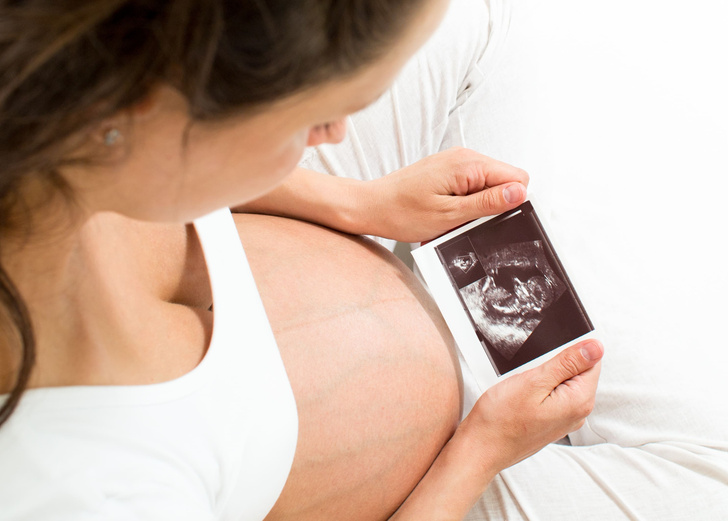 «Что будет, если часто делать УЗИ во время беременности?»