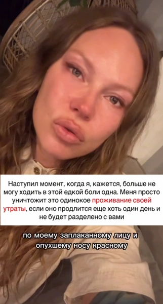 Рита не скрывала своего лица после неудачной блефаропластики