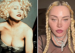 Из секс-символа в «пьяного гуманоида»: косметолог рассказал, какие процедуры изуродовали 63-летнюю Мадонну