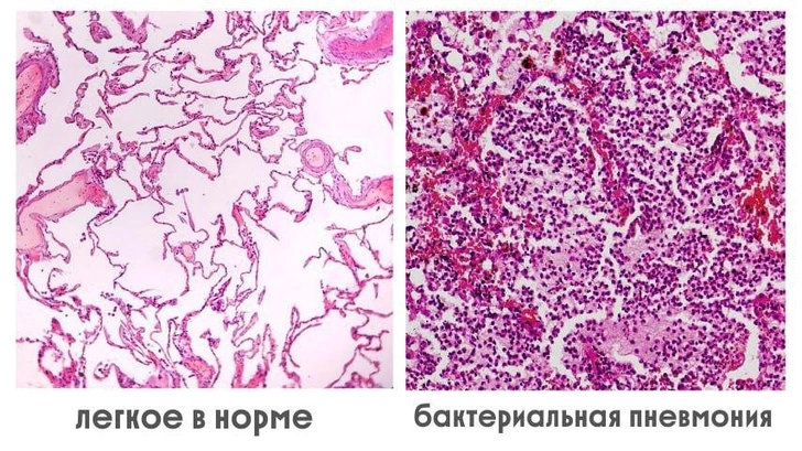 Источник: t.me/ikb2dzm