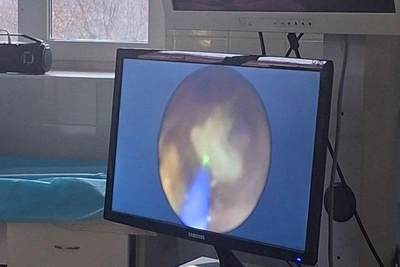 В Ессентуках ребенку лазером удалили камень из мочеточника