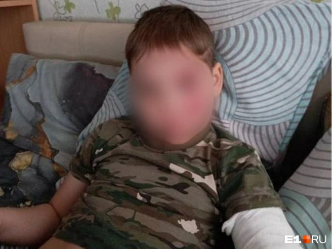 Мальчику диагностировали ушибы и перелом руки. Сейчас он на больничном | Источник: читательница E1.RU Анастасия