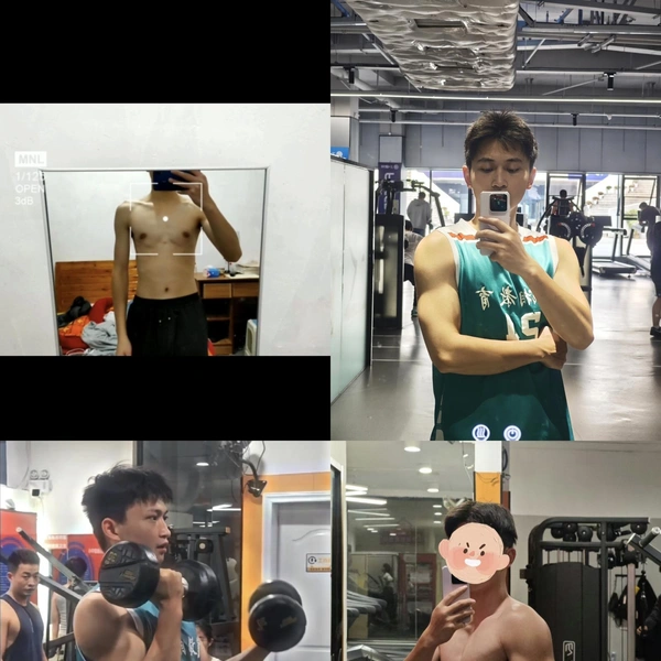 Филлеры? Нет, не слышали | Источник: соцсети