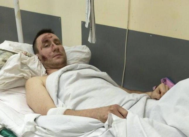 Мужчина с переломами лежит в больнице, пока родственники ищут свидетелей ДТП | 76.ru