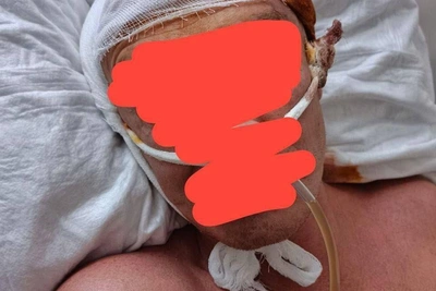 В Самарской области мужчине сделали трепанацию после вызова полиции